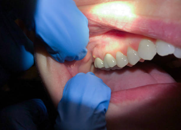 Best Emergency Dental Care for Trauma or Injury in New Windsor, MD